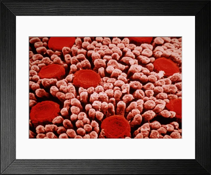 Framed Print : Surface of tongue Framed Print : Surface of tongue