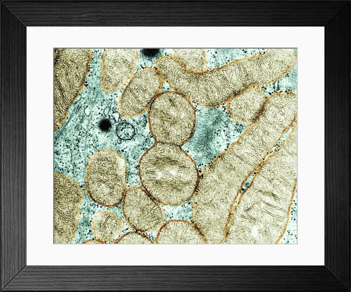 Framed Print : Dividing Mitochondrion, TEM Framed Print : Dividing Mitochondrion, TEM