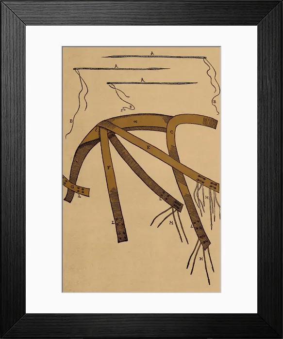 Framed Print : Tagliacozzi Rhinoplasty Method Equipment Framed Print : Tagliacozzi Rhinoplasty Method Equipment