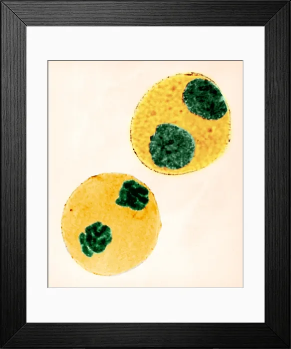 Framed Print : Mitosis in Trillium Cell, light micrograph Framed Print : Mitosis in Trillium Cell, light micrograph