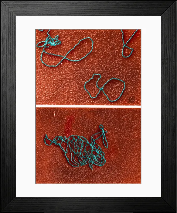 Framed Print : Circular DNA and Polymerase Reaction, TEM