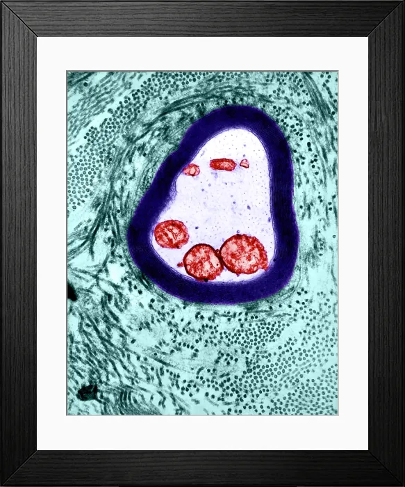 Framed Print : Nervous System, Myelinated Axon, TEM Framed Print : Nervous System, Myelinated Axon, TEM