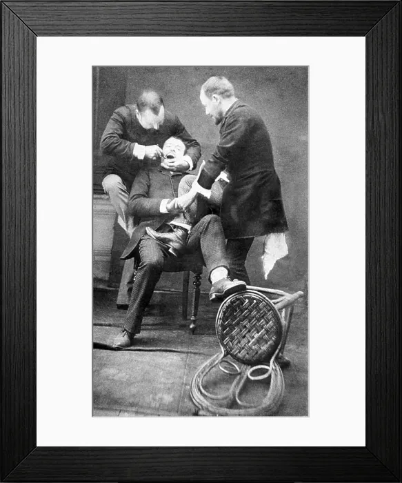 Framed Print : Dentistry, Tooth Extraction, 1892