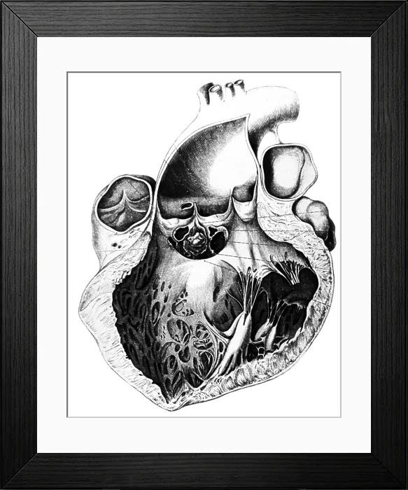 Framed Print : Heart Anatomy, Carl von Rokitansky, 1875 Framed Print : Heart Anatomy, Carl von Rokitansky, 1875