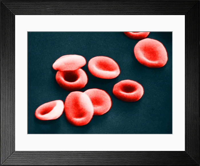 Framed Print : Red Blood Cells, under a microscope (SEM) Framed Print : Red Blood Cells, under a microscope (SEM)