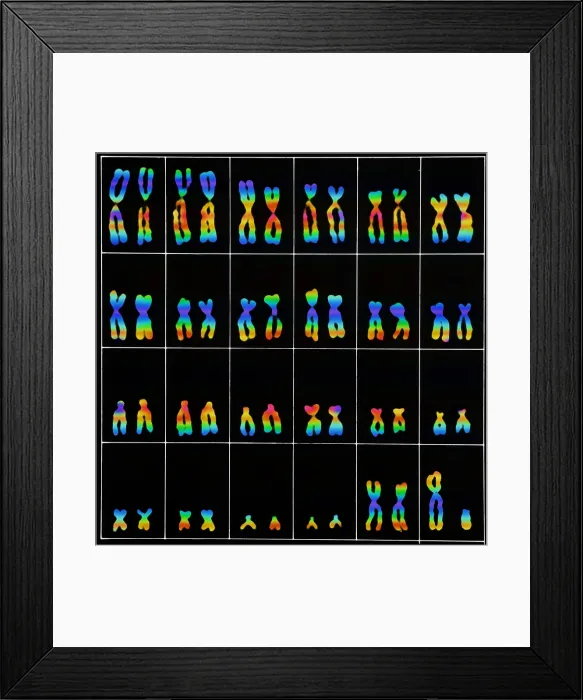 Framed Print : Karyotype, Normal Male Chromosomes Framed Print : Karyotype, Normal Male Chromosomes