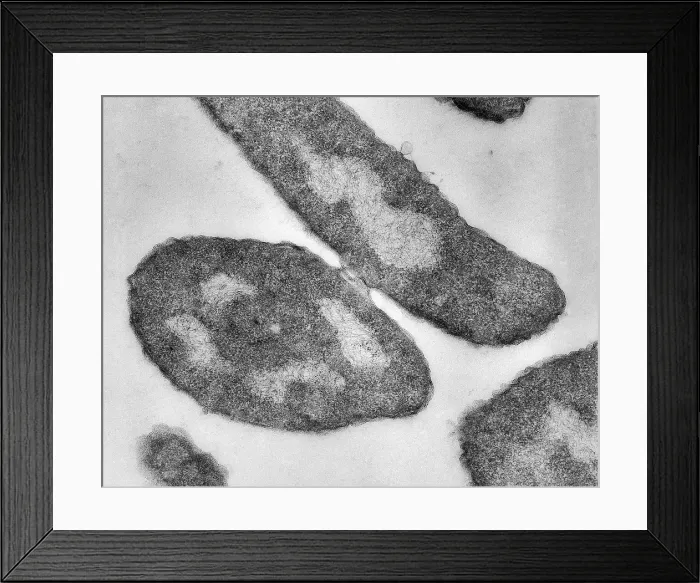 Framed Print : Bacteria, Genetic Recombination, TEM
