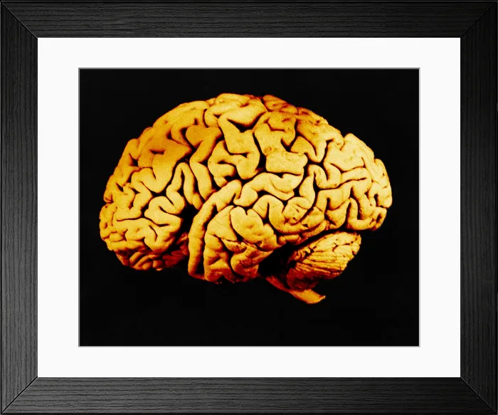 Framed Print : Human Brain Framed Print : Human Brain