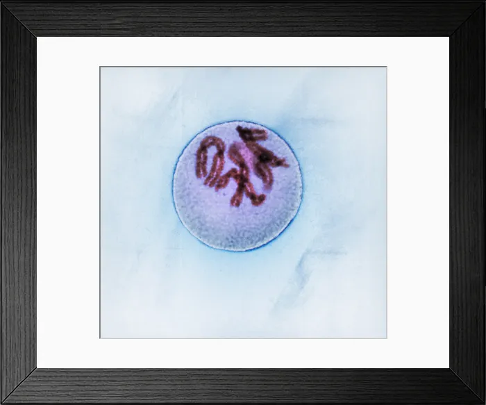 Framed Print : Prophase of Mitosis in Trillium Cell Framed Print : Prophase of Mitosis in Trillium Cell