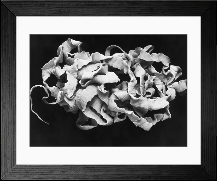 Framed Print : Human Tapeworm, gross specimen Framed Print : Human Tapeworm, gross specimen