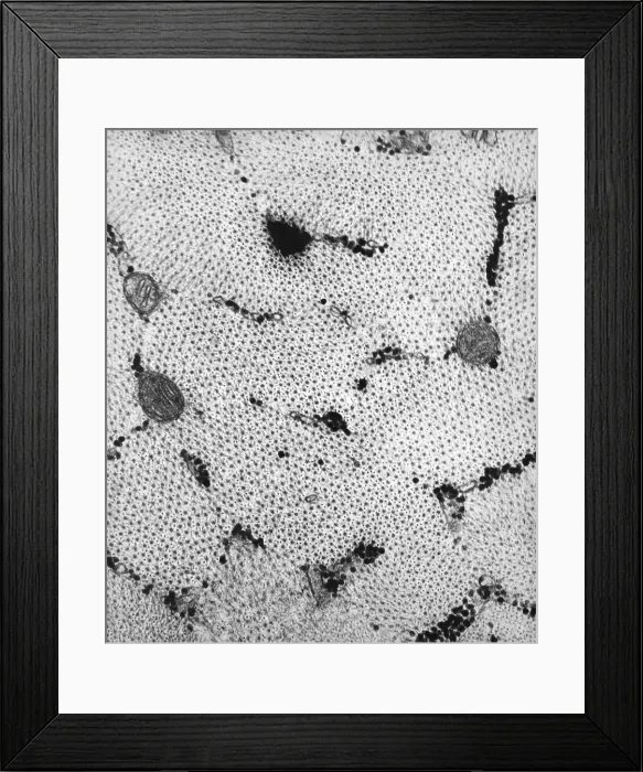 Framed Print : Connective Tissue, Skeletal Muscle, TEM Framed Print : Connective Tissue, Skeletal Muscle, TEM