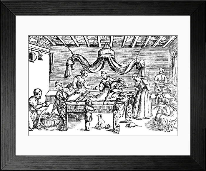 Framed Print : Trepanning, 1573 Framed Print : Trepanning, 1573