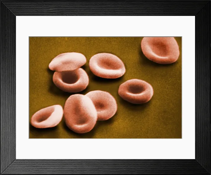 Framed Print : Red Blood Cells, under a microscope (SEM) Framed Print : Red Blood Cells, under a microscope (SEM)