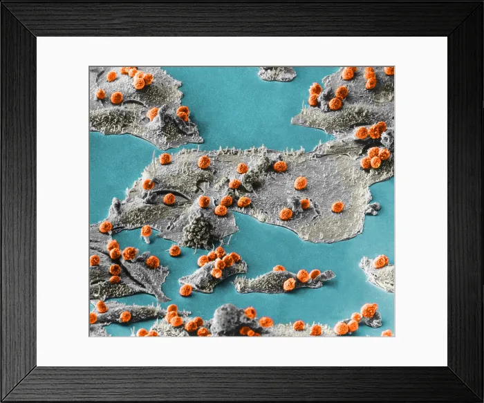 Framed Print : Immune Cells Attacking Cancer Cells, under a microscope (SEM) Framed Print : Immune Cells Attacking Cancer Cells, under a microscope (SEM)