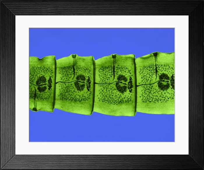 Framed Print : Dog Tapeworm under a microscope Framed Print : Dog Tapeworm under a microscope