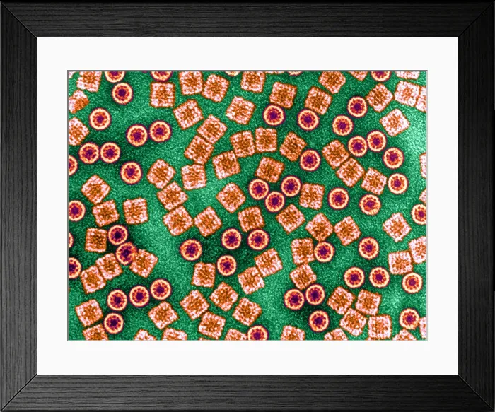 Framed Print : Respiratory Protein, Hemocyanin, TEM Framed Print : Respiratory Protein, Hemocyanin, TEM