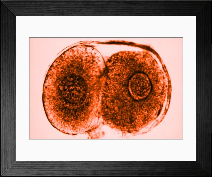 Framed Print : Human Reproduction, Ovum, Zygote Cell Stage, TEM Framed Print : Human Reproduction, Ovum, Zygote Cell Stage, TEM