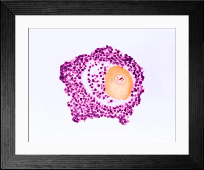 Framed Print : Ovarian egg Framed Print : Ovarian egg