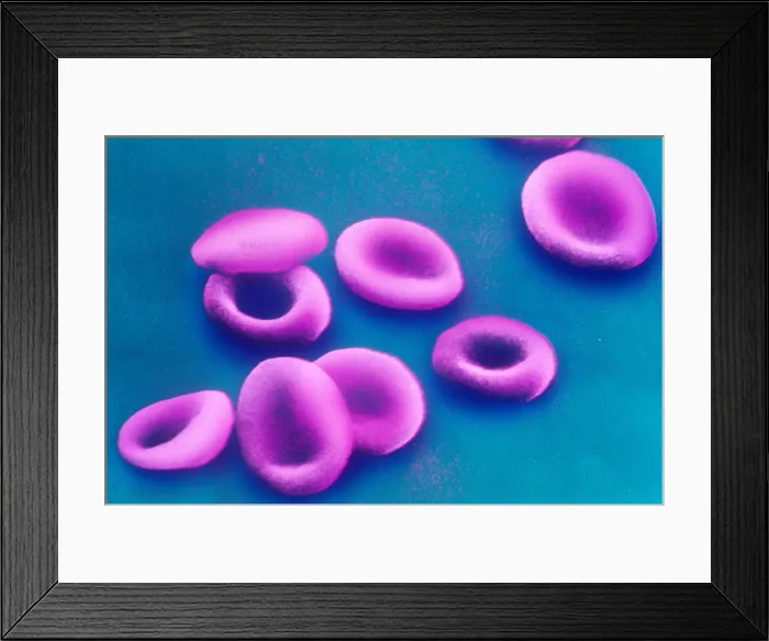 Framed Print : Red Blood Cells, under a microscope (SEM) Framed Print : Red Blood Cells, under a microscope (SEM)