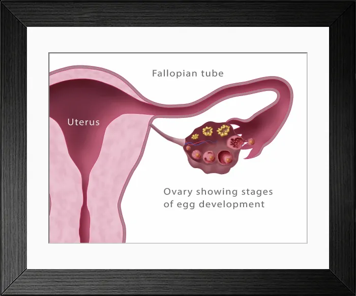 Framed Print : Ovarian Follicles, Menstruation, Illustration Framed Print : Ovarian Follicles, Menstruation, Illustration