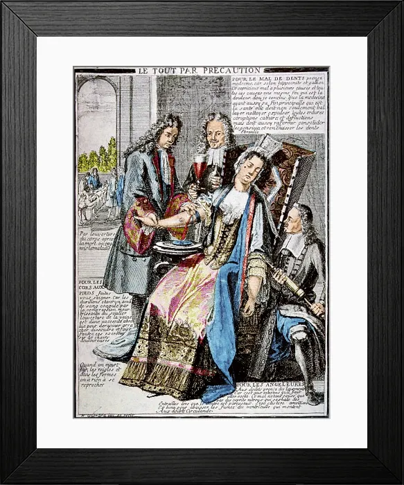 Framed Print : Bloodletting, 17th Century Framed Print : Bloodletting, 17th Century