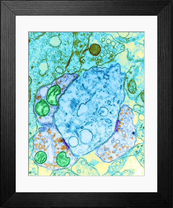Framed Print : Synapse, TEM Framed Print : Synapse, TEM