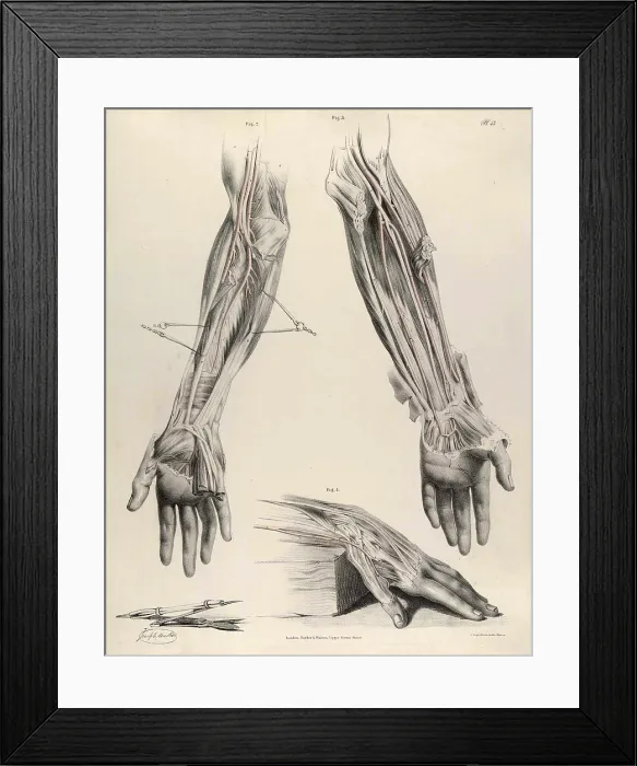 Framed Print : Historical Anatomical Illustration
