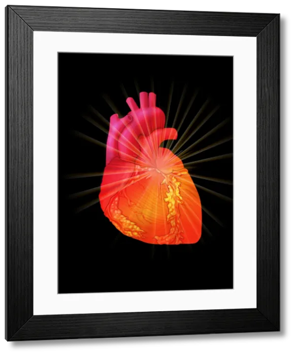 Framed Print : Heart Attack, Conceptual Illustration Framed Print : Heart Attack, Conceptual Illustration