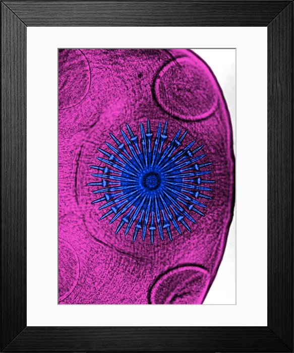 Framed Print : Dog Tapeworm Rostellum (LM) under a microscope Framed Print : Dog Tapeworm Rostellum (LM) under a microscope