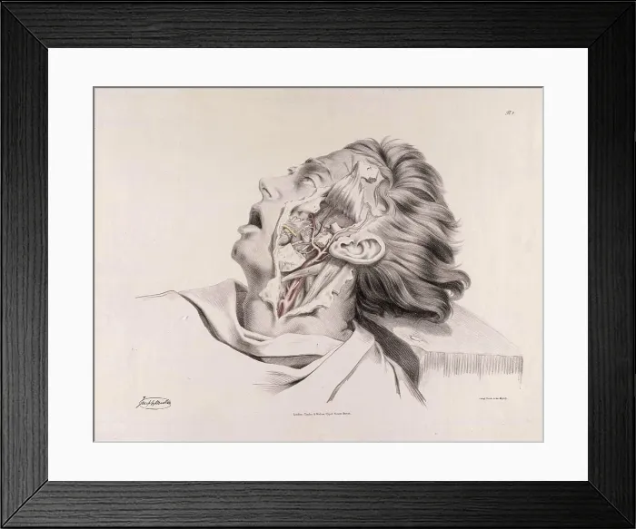 Framed Print : Historical Anatomical Illustration