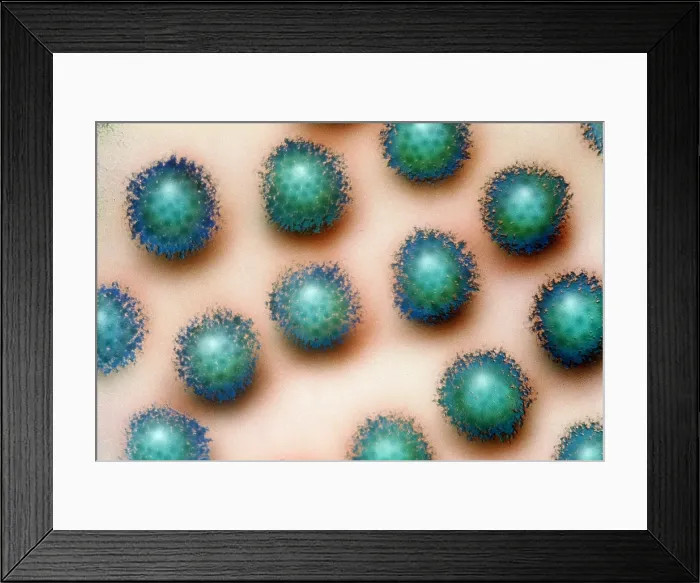 Framed Print : Adenovirus Framed Print : Adenovirus