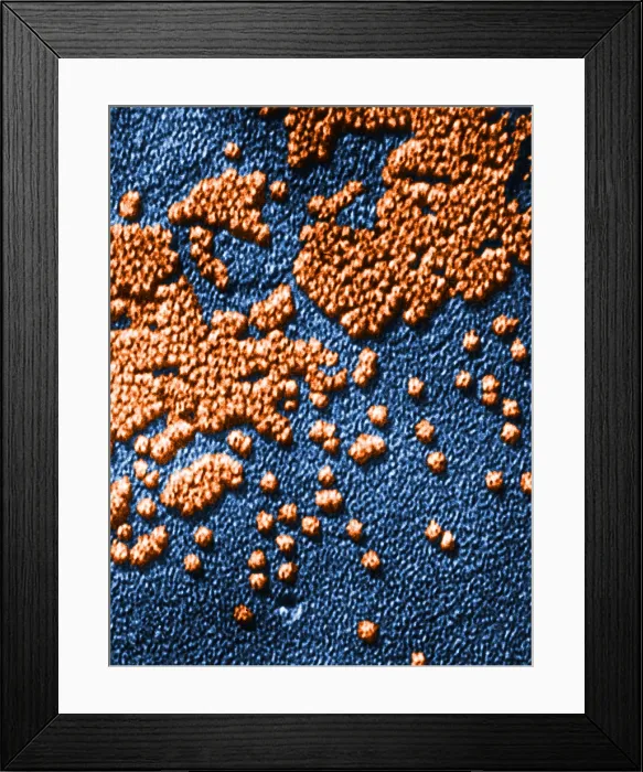 Framed Print : Hepatitis Virus Framed Print : Hepatitis Virus