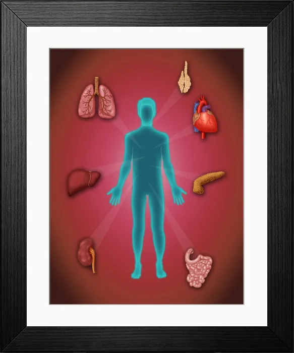 Framed Print : Organ Transplant, Illustration