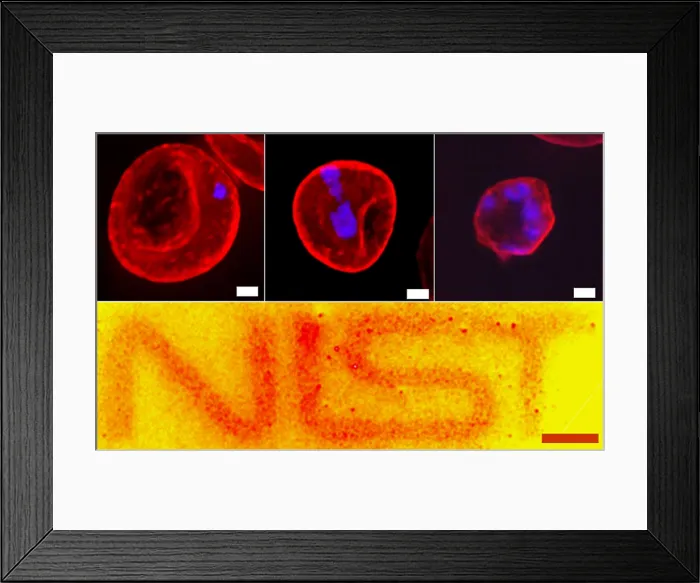 Framed Print : Quantum Dots, Malaria Progression, under a microscope (SEM) Framed Print : Quantum Dots, Malaria Progression, under a microscope (SEM)