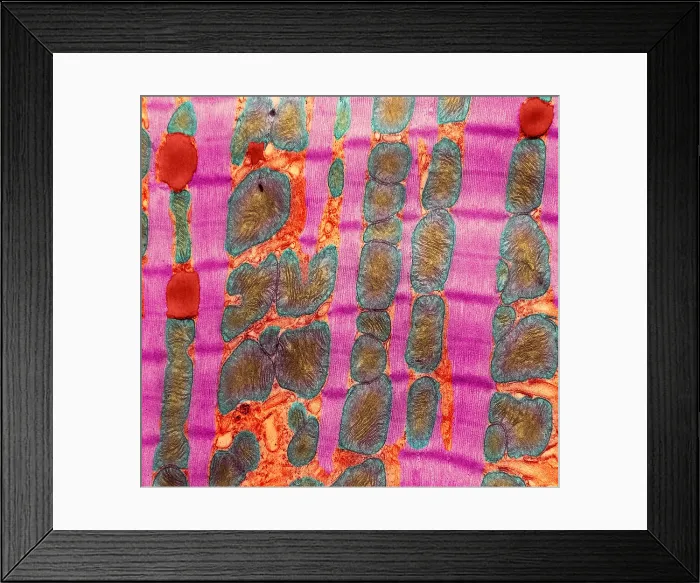 Framed Print : Cardiac Muscle, TEM