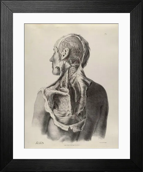 Framed Print : Historical Anatomical Illustration Framed Print : Historical Anatomical Illustration
