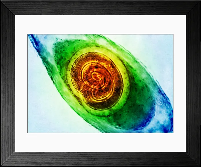 Framed Print : Trichinella in Muscle, light micrograph