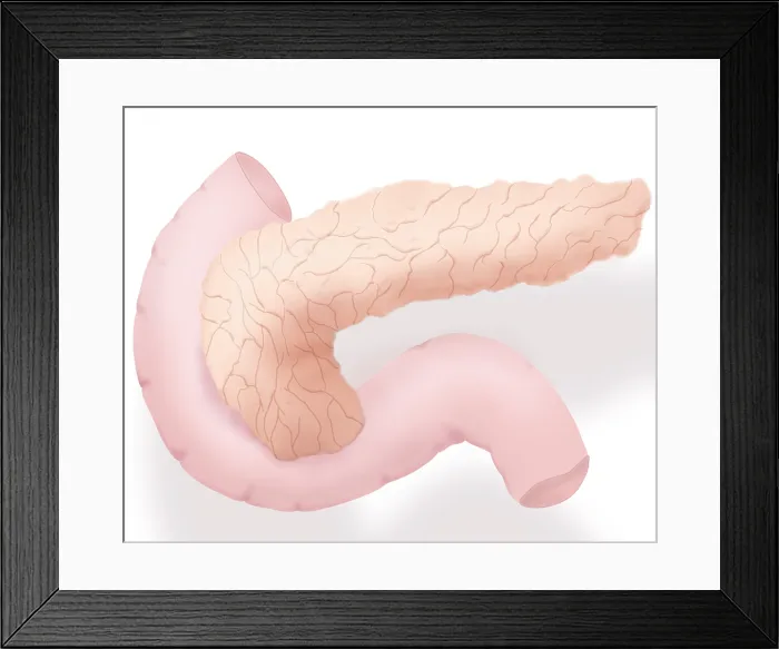 Framed Print : Pancreas Illustration
