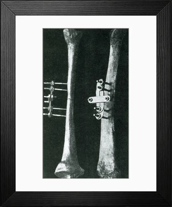 Framed Print : Bone Clamp Framed Print : Bone Clamp
