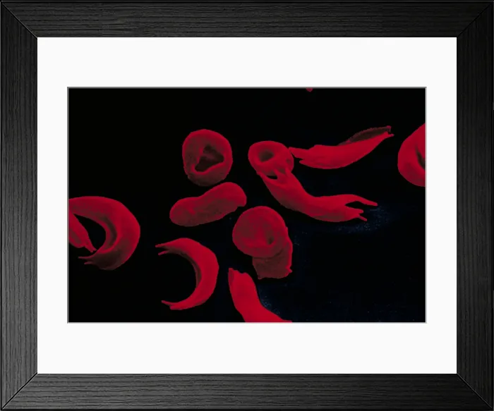 Framed Print : Red blood cells Framed Print : Red blood cells