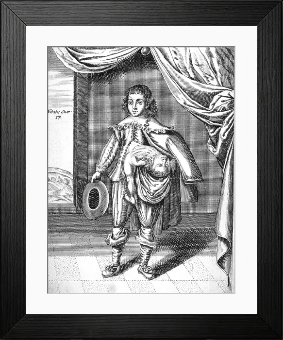 Framed Print : Parasitic Twin, 1686 Framed Print : Parasitic Twin, 1686
