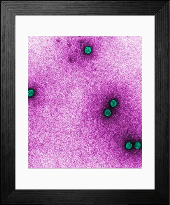Framed Print : TEM of Rhinoviruses Framed Print : TEM of Rhinoviruses