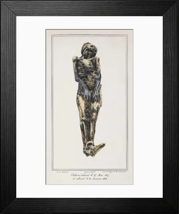 Framed Print : Mathieu Orfila, Decomposition On Exhumed Bodies, 1831 Framed Print : Mathieu Orfila, Decomposition On Exhumed Bodies, 1831
