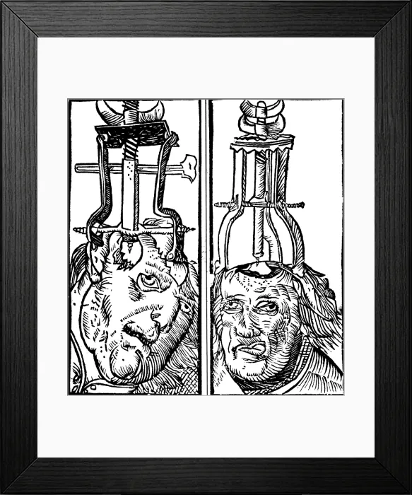 Framed Print : Trepanning, 1525 Framed Print : Trepanning, 1525