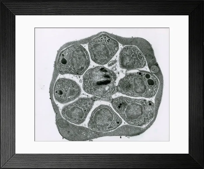 Framed Print : RBC Infected with Malarial Parasite, TEM Framed Print : RBC Infected with Malarial Parasite, TEM