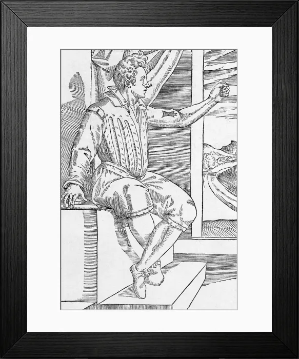 Framed Print : One of Tagliacozzi's Rhinoplasty Methods, 6 of 6 Framed Print : One of Tagliacozzi's Rhinoplasty Methods, 6 of 6