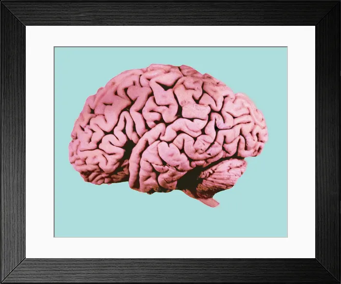Framed Print : Human Brain Framed Print : Human Brain