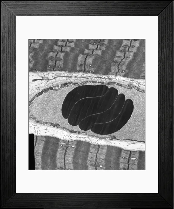 Framed Print : Erythrocytes, Capillary, Muscle Fibers, TEM
