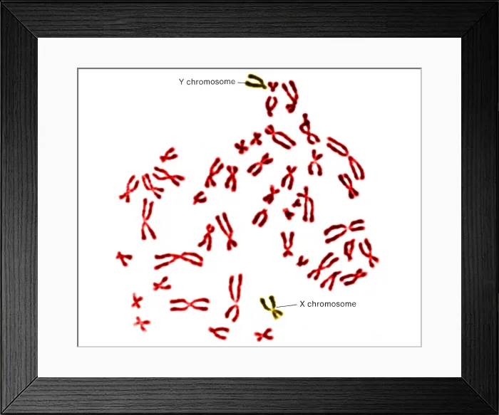 Framed Print : Karyotype, Normal Male Chromosomes Framed Print : Karyotype, Normal Male Chromosomes