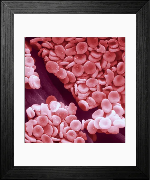 Framed Print : Circulatory System, Red Blood Cells, under a microscope (SEM) Framed Print : Circulatory System, Red Blood Cells, under a microscope (SEM)